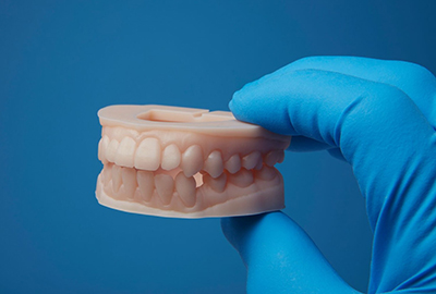 3D print - permanent crowns