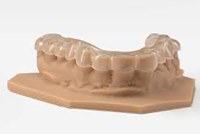 3D print - occlusal splints and guards