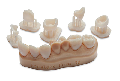 3D print - permanent crowns