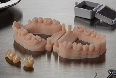 3D print - restorative models