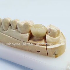 Our Dental Laboratory Products